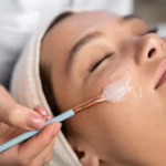 chemical peeling in Chennai