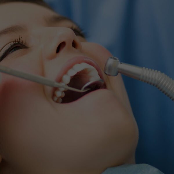 houston emergency dental services