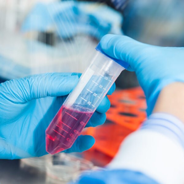 The Role of Human Serum Samples in Advancing Tumor Tissue-Based Cancer Research