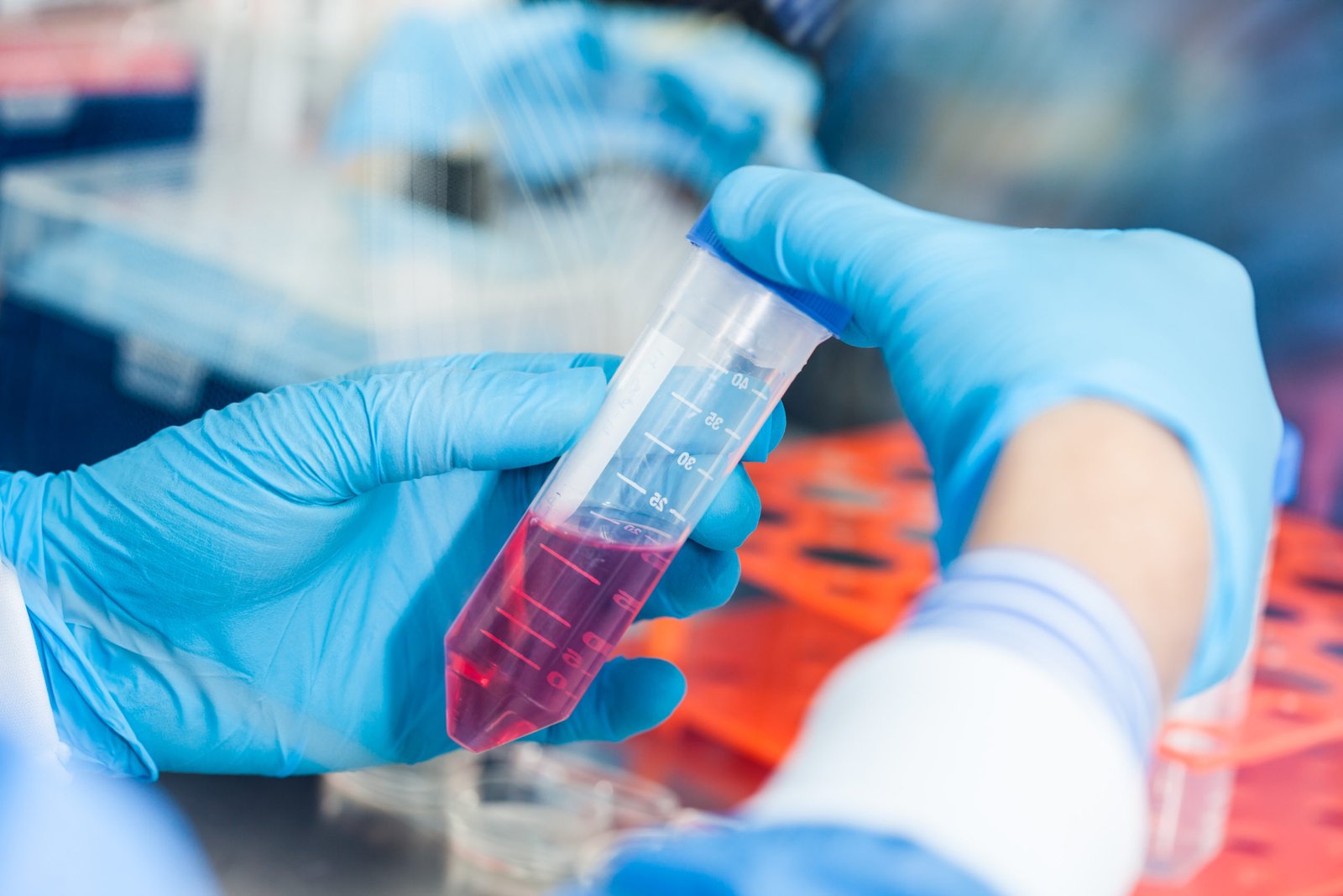The Role of Human Serum Samples in Advancing Tumor Tissue-Based Cancer Research