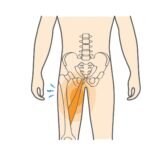 Groin Strain vs Groin Pull