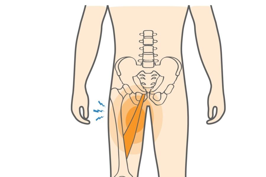Groin Strain vs Groin Pull