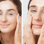 Lymphatic Drainage Facial Before and After