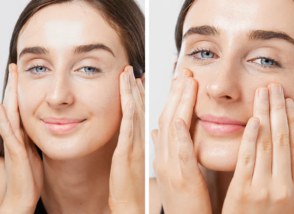 Lymphatic Drainage Facial Before and After