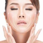 Non-Surgical Facelift