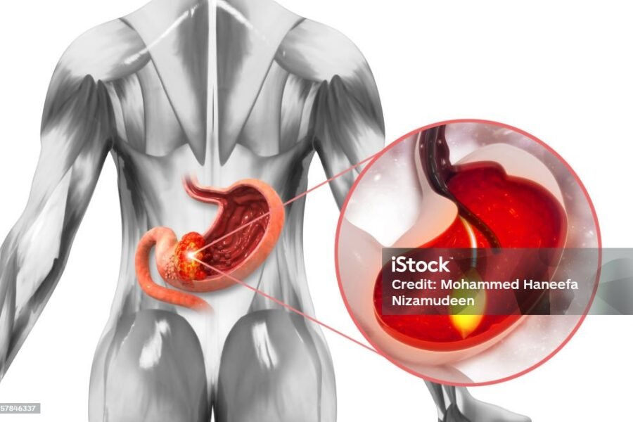 What are Zentel 400Mg Used for