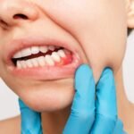 gum repair treatment