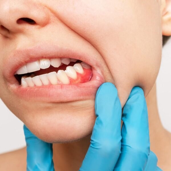 gum repair treatment