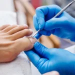 5 Signs You Should Book Professional Footcare in Edinburgh