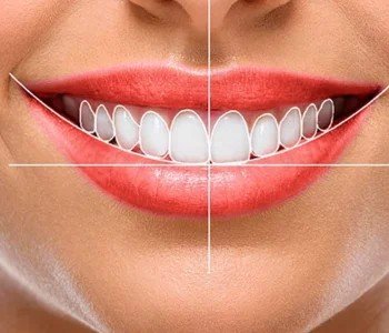 Teeth whitening
