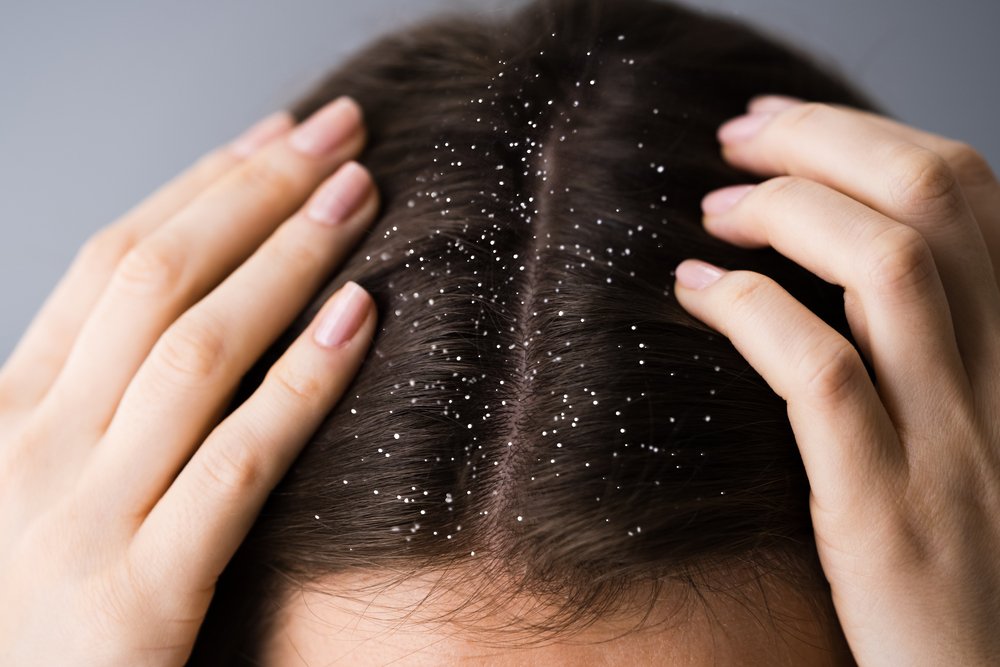 Best Shampoo for dandruff