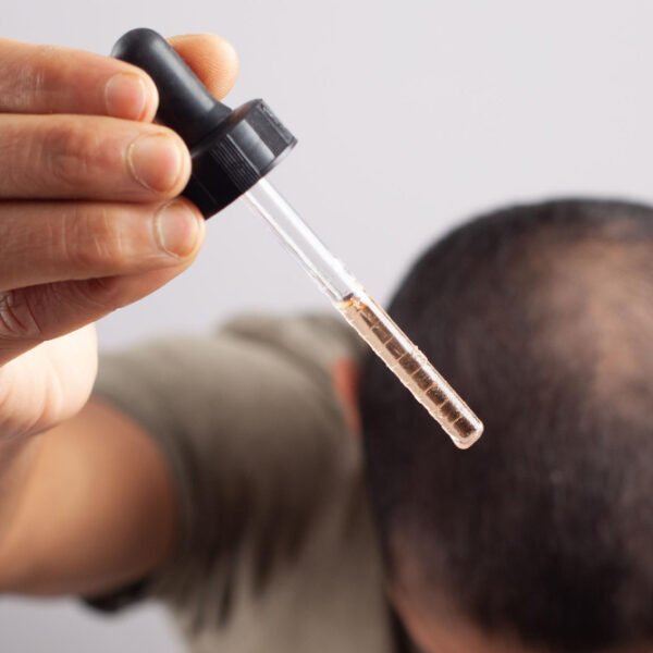 man using serum on scalp