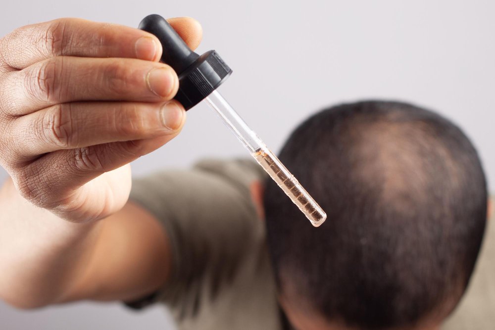 man using serum on scalp