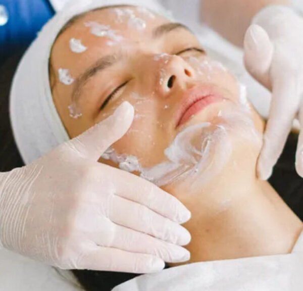 Vampire facial