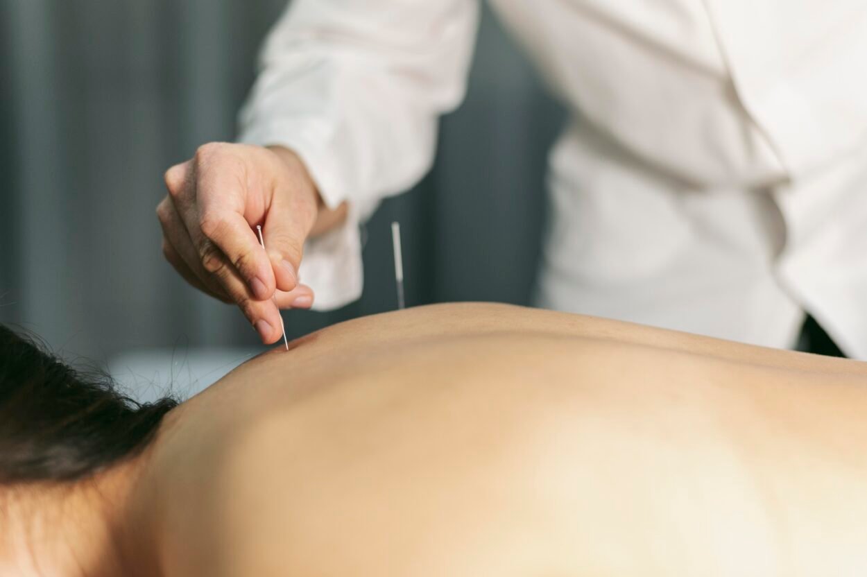 acupuncture for hormonal balance