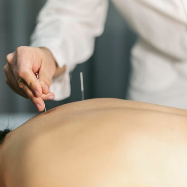 acupuncture for hormonal balance