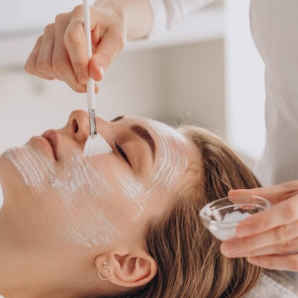 chemical-peel-treatment