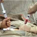 bone marrow transplant