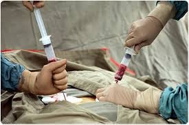 bone marrow transplant