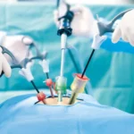 Surgical