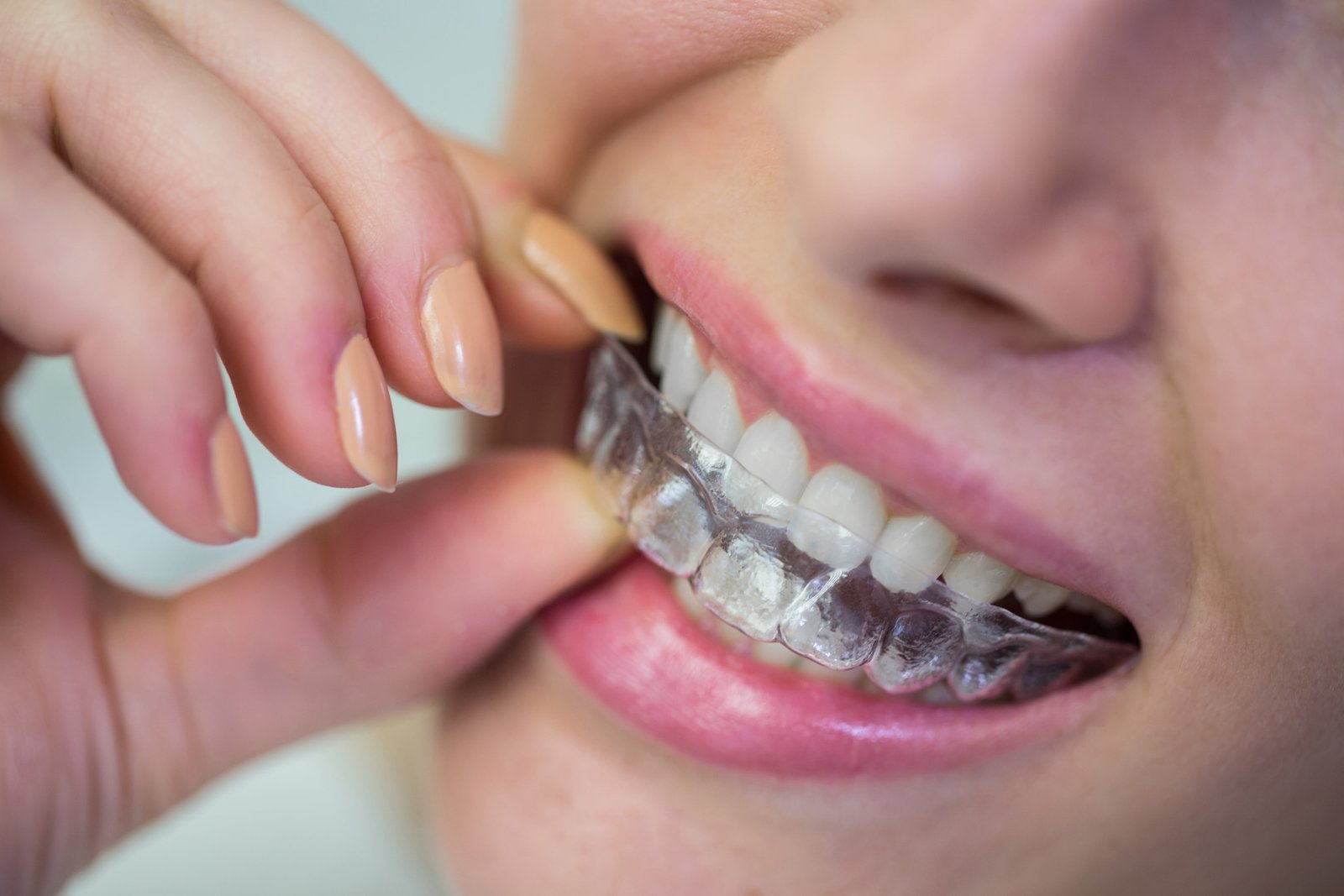 Invisalign in Brockton: Comfortable, Clear, and Effective